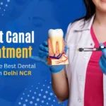 root canal treatment near me