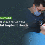 Implant Supported Dentures Delhi