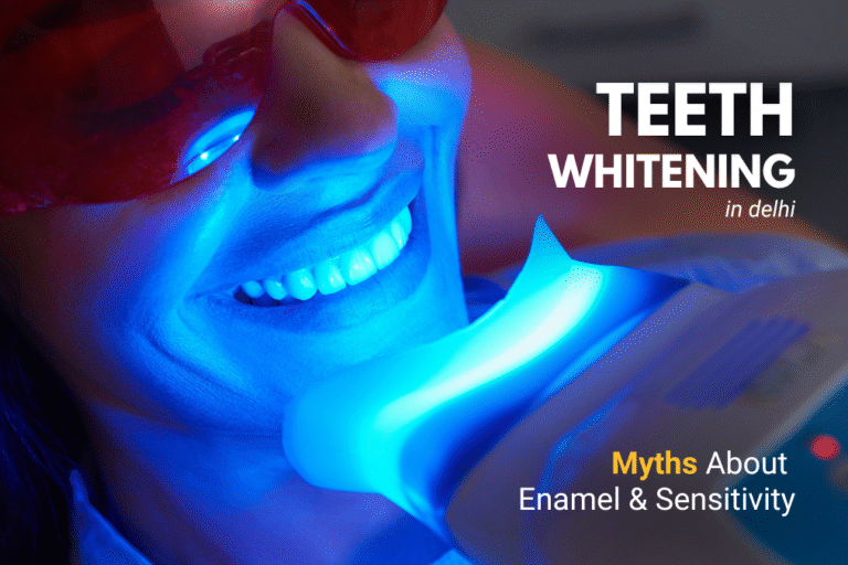 teeth whitening in Delhi